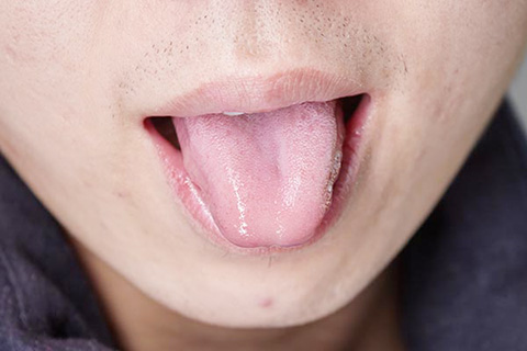 舌头是人体的重要组成部分