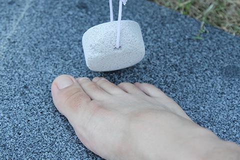 跖疣是种常见的疾病