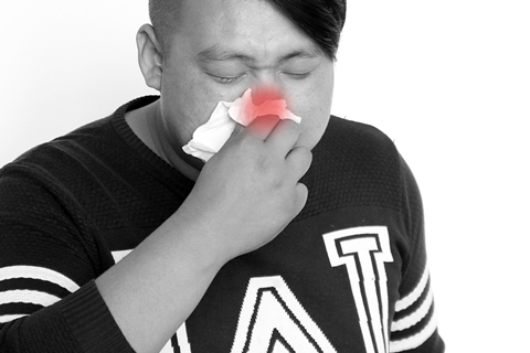 鼻窦炎有哪些症状
