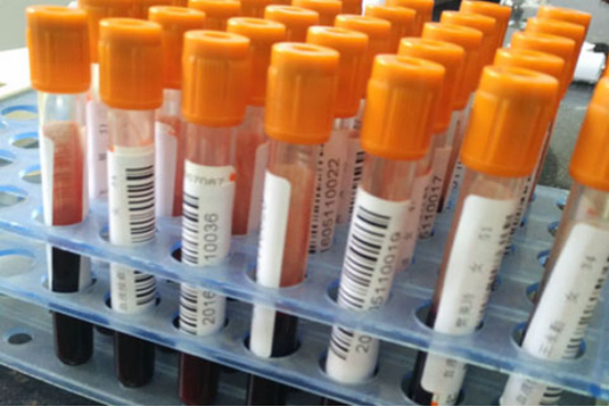 心肌酶是通过外周血静脉抽血检查了解心肌酶的数值诊断心肌缺血或者心肌梗死等心脏疾病的指标