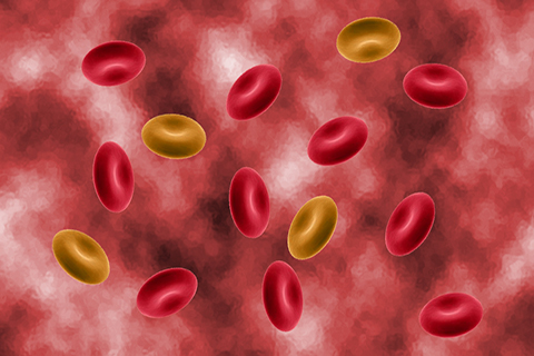 甘油三酯高往往会伴随高密度脂蛋白水平下降和低密度脂蛋白水平升高 甘油三酯高往往会伴随高密度脂蛋白水平下降和低密度脂蛋白水平升高