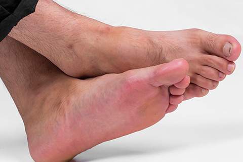 中风也会导致腿麻出现