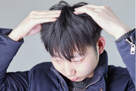 痘痘是一种常见的皮肤问题 痘痘是一种常见的皮肤问题