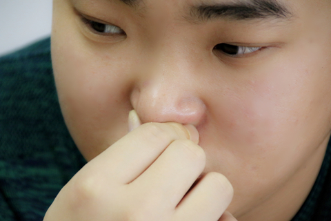 流清鼻涕怎么办_民福康