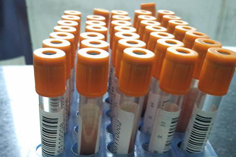 血hcg太早验没有意义