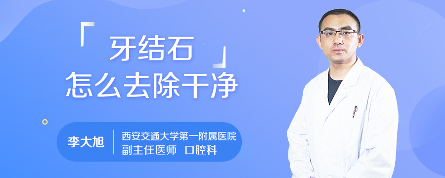 牙结石怎么去除干净