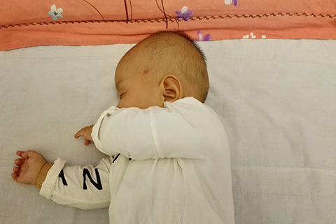 其多发于婴幼儿时期