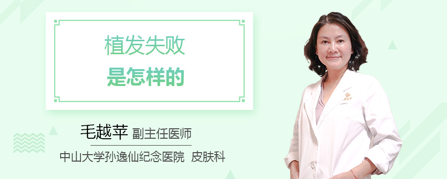 植发失败是怎样的