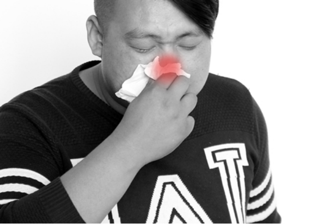 相信大家都知道鼻炎，在生活中有许多人都得过鼻炎，而过敏性鼻炎是鼻炎中常见的一种