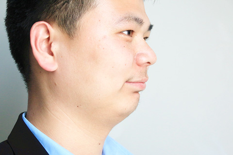 面瘫是常见的一种疾病