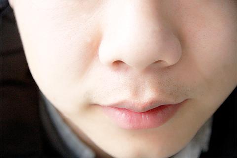 干燥症有哪些症状