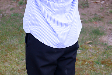 很多年轻人可能会出现痔疮