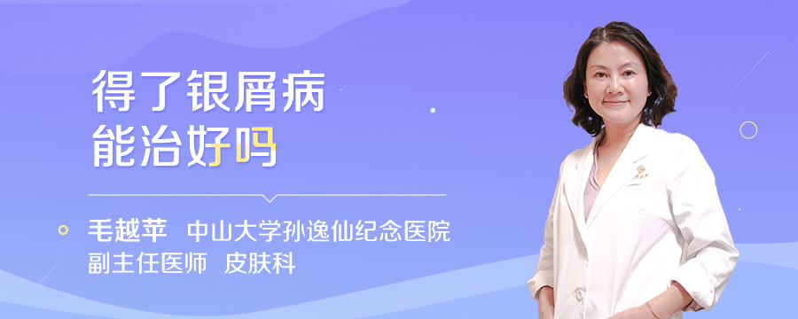 得了银屑病能治好吗