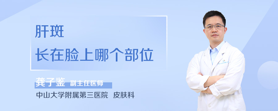 肝斑长在脸上哪个部位
