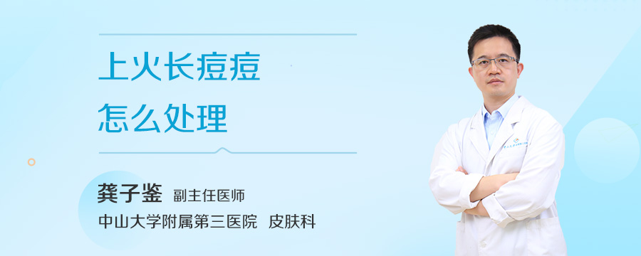 上火长痘痘怎么处理