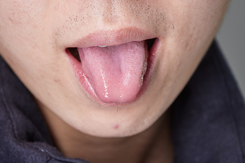舌乳头 两侧图片