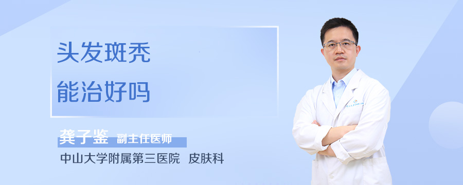 头发斑秃能治好吗
