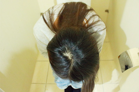 孕中期便秘严重怎么办 孕中期便秘严重怎么办