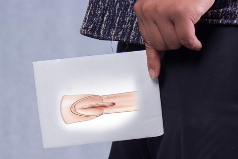 背神经阻断术在医学上,又被称为阴茎背神经选择性阻断术 背神经阻断术在医学上,又被称为阴茎背神经选择性阻断术