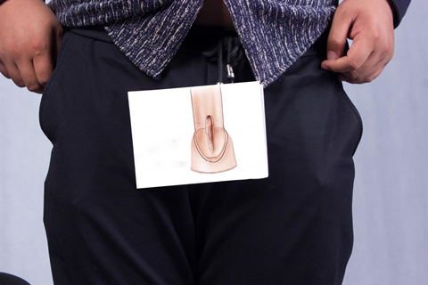 精液颜色为黄绿色或棕色脓性时，这有一定几率为男性生殖道或副性腺的炎症引起的