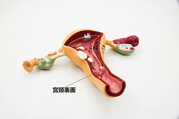 一部分人在检查的时候，发现宫颈低度病变就会十分担心