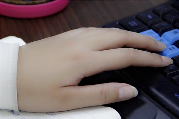 不少女性到怀孕后期会出现手肿胀的情况