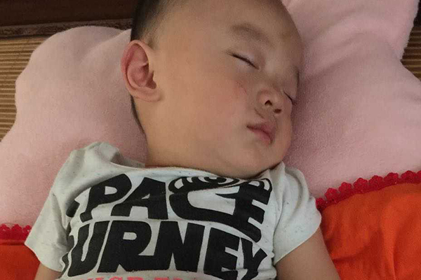 新生儿出现黄疸是常见的一种现象,但是黄疸也是可以预防的 新生儿出现黄疸是常见的一种现象,但是黄疸也是可以预防的