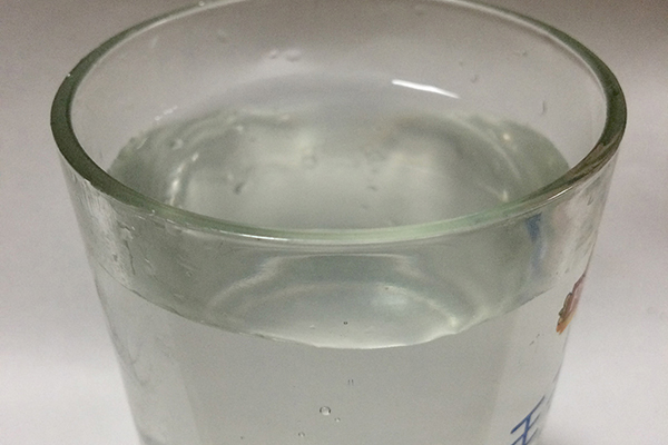 女性做腹部B超需要憋尿，喝水可以增加尿意形成尿液