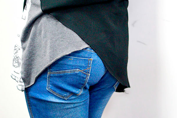 痔疮相信许多人都知道，这是一种很常见的身体问题，有很多人都有过痔疮