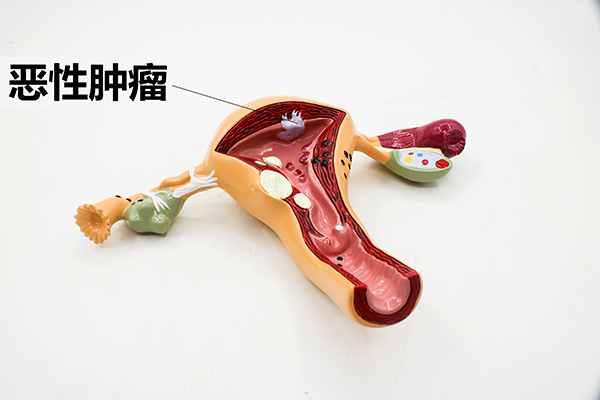 虽然现在的医疗水平提高了许多，但是人们依旧是谈癌色变