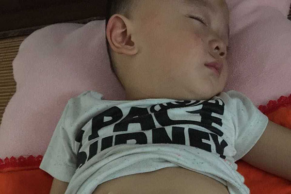 飞机手是指宝宝不管做什么，两条手臂经常张开，不会做出把手放在胸前的动作