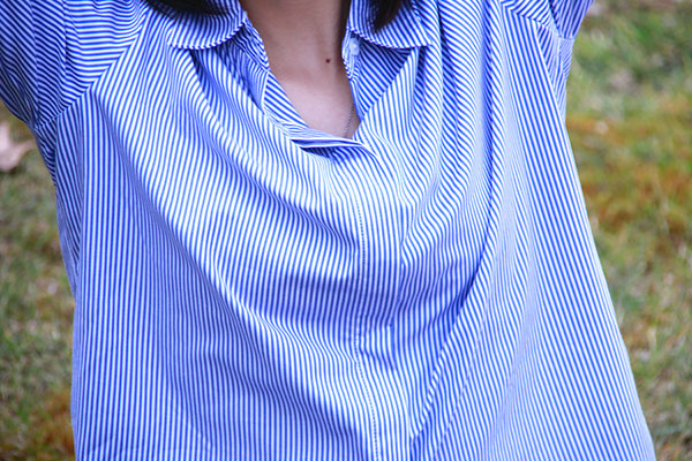 发生浆细胞乳腺炎病因跟女性的生活习惯有一定的关系 发生浆细胞乳腺炎病因跟女性的生活习惯有一定的关系