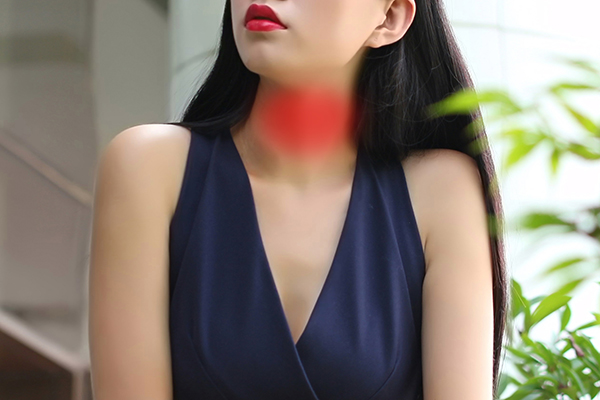 亚急性甲状腺炎的治疗主要是抗炎治疗。