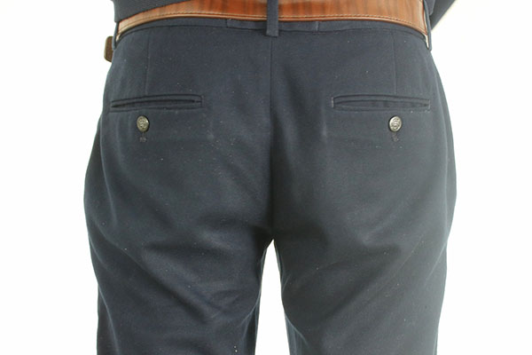 肛门痛多半是因为肛裂。