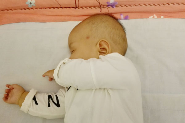 小儿肺炎如何护理