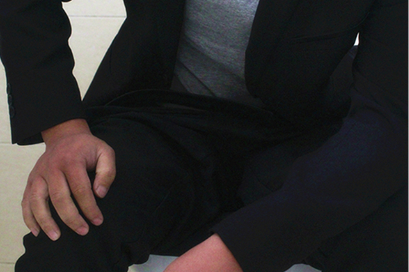 大便干结成颗粒状是非常常见的。 大便干结成颗粒状是非常常见的。