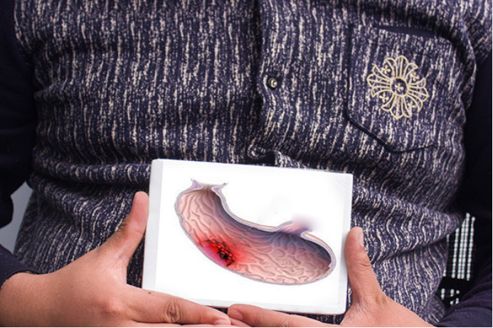 胃溃疡患者可以多清淡的食物比如米粥、面条、鱼汤等