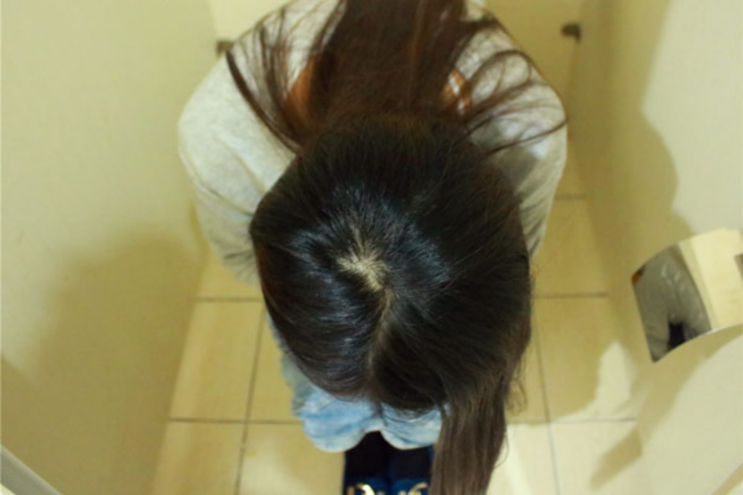 一般情况下，大便深绿色警示肠道可能存在问题。