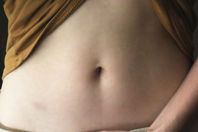 肚脐周围摸起来很硬但按压肚子没有疼痛感就是正常现象 肚脐周围摸起来很硬但按压肚子没有疼痛感就是正常现象