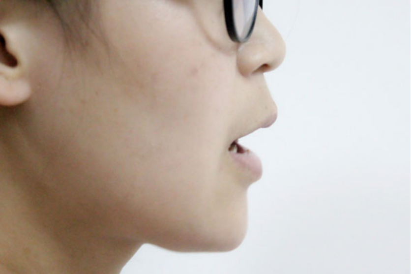 打嗝是一种再正常不过的生理现象。