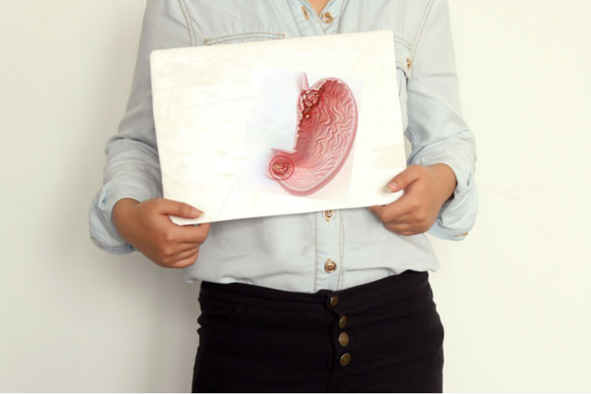 一般来说正常人体内是没有幽门螺杆菌的。