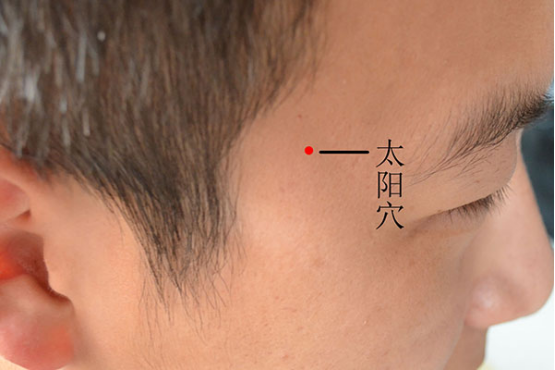 太阳穴长痘什么原因