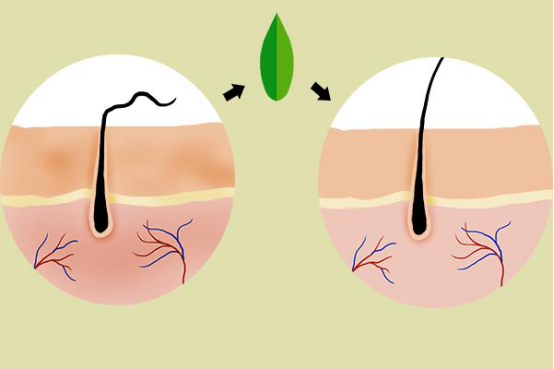 洗完头刚干全是头皮屑 洗完头刚干全是头皮屑