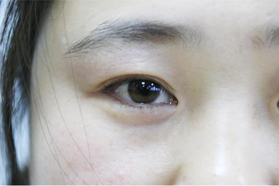 对于女性朋友们来说，内分泌失调是非常常见的一种情况，经常精神过于紧绷，身体过于劳累，长时间处于不良的情绪当中，都很容易导致内分泌失调。