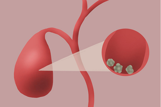 胆可以储存胆汁，但是当人体进食后，胆能够及时排出胆汁，参与食物的消化，保证肠胃功能的正常运行