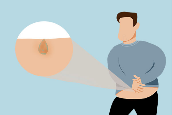 虽然肚脐部位会产生很多的脏东西，但是如果你经常去抠的话，肚脐部位会失去保护