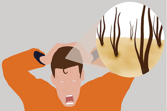 这种问题一般不会自己自愈,是需要通过一定的生活调节和治疗来改善的 这种问题一般不会自己自愈,是需要通过一定的生活调节和治疗来改善的