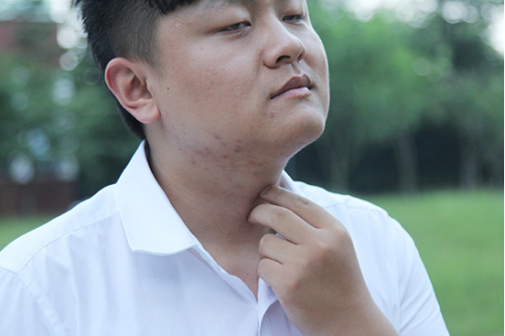 治疗反流食道炎的方法有很多，先将自己的饮食和生活习惯调整好是非常有必要的