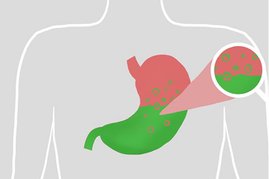 胃寒的人首先要进行胃部的保暖工作，避免胃部再次收到伤害
