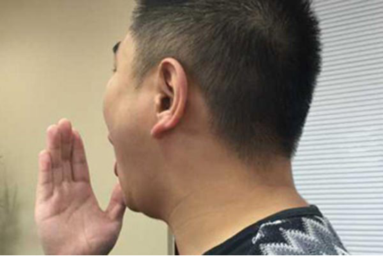 幽门螺杆菌也会带来一些有异味的代谢废物,这些代谢废物长时间留在胃里,异味就会顺着肠道进入嘴巴,嘴巴也会变臭 幽门螺杆菌也会带来一些有异味的代谢废物,这些代谢废物长时间留在胃里,异味就会顺着肠道进入嘴巴,嘴巴也会变臭